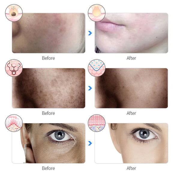 Radiant Skin LED Beauty Mask